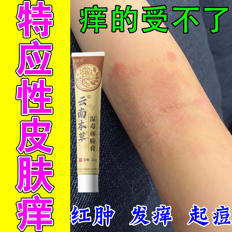 特应性发痒胳膊肘窝痒疙瘩红肿天热肘窝发红发痒修护草本软膏