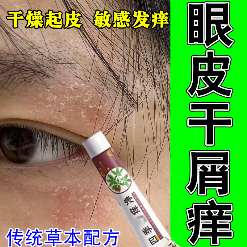 眼皮周围眼睛粗糙痒干燥掉屑红肿痒过敏发痒神经性舒缓草本保湿膏