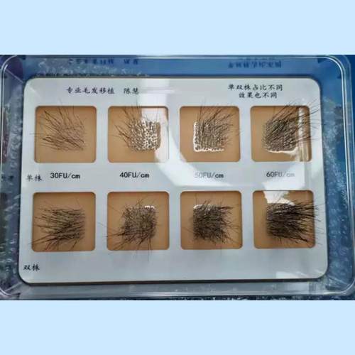 植发密度模型，植发模型，植发密度展示，，植发咨询室摆件