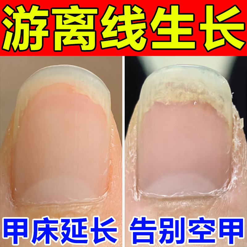 指甲游离线生长液护甲油萎缩增长液延长营养油养甲床分离空甲修复