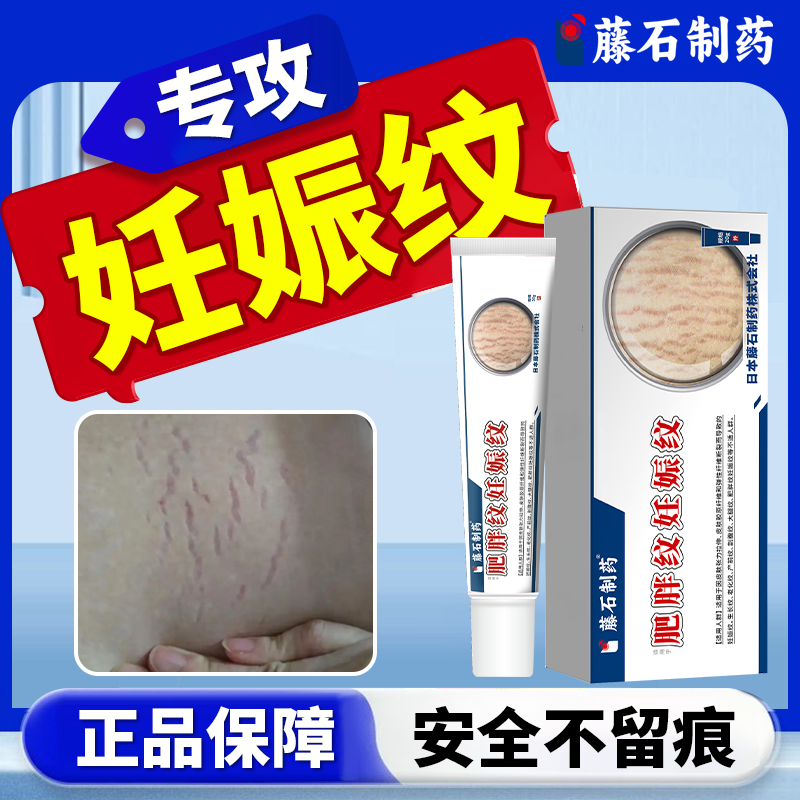 妊辰纹消除去i妊娠纹紧致肚皮修复霜疤痕除疤膏淡化祛可搭精油ZR