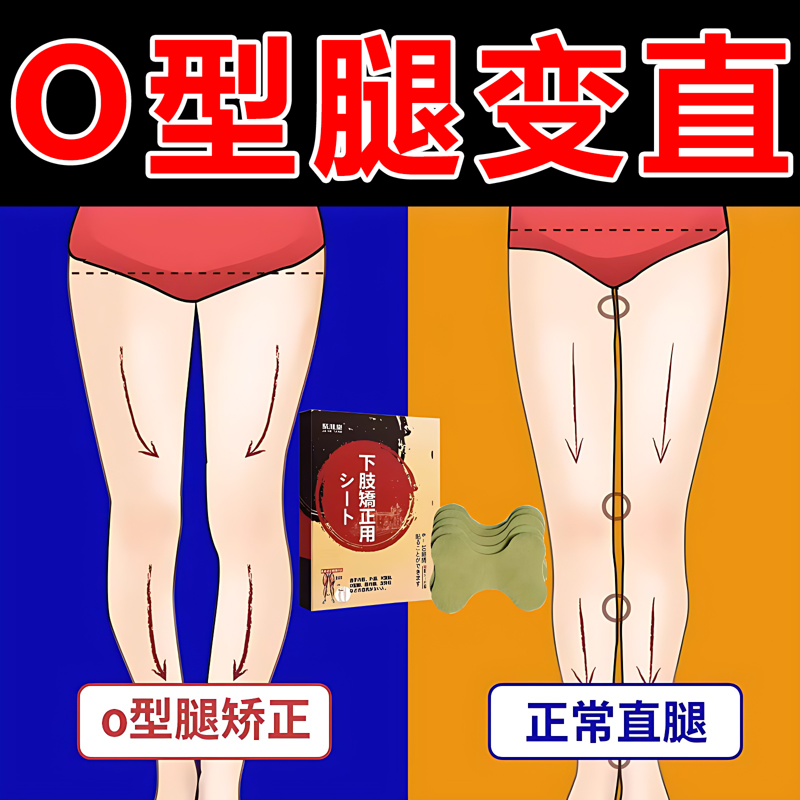o型腿矫正神器纠正小腿外翻罗圈腿形xo鞋垫腿部儿童腿型x型直腿贴