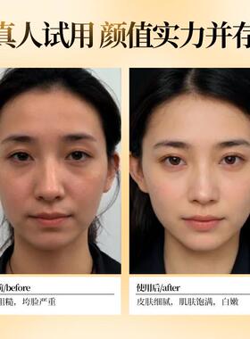 TYI抗LLO泰洛美国进胶原蛋口白肽片口服氧糖化美白XVZ丸全身焕白