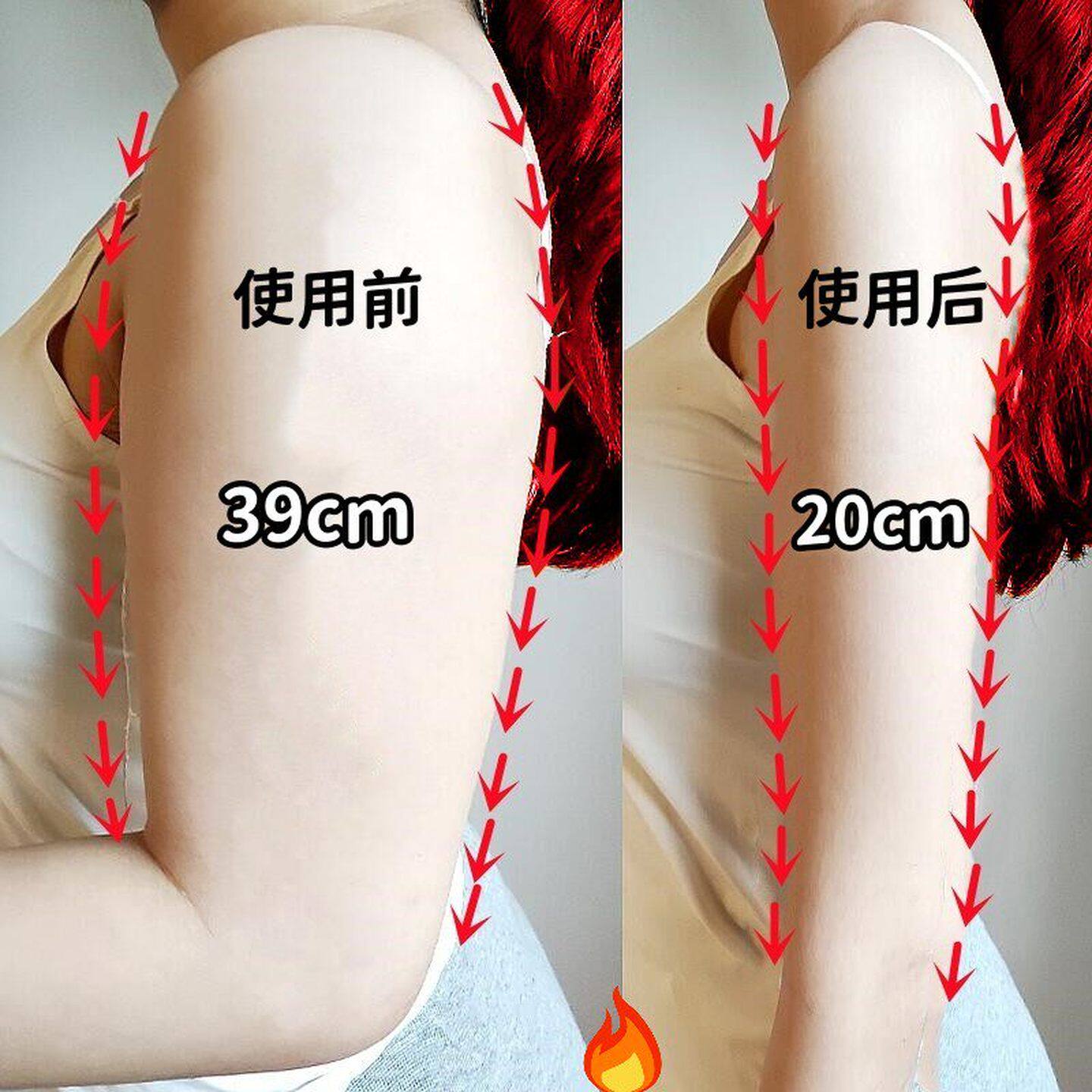 快速去手臂神器大粗胳膊细蝴蝶减拜拜肉粗粗臂女神贴 买3送2