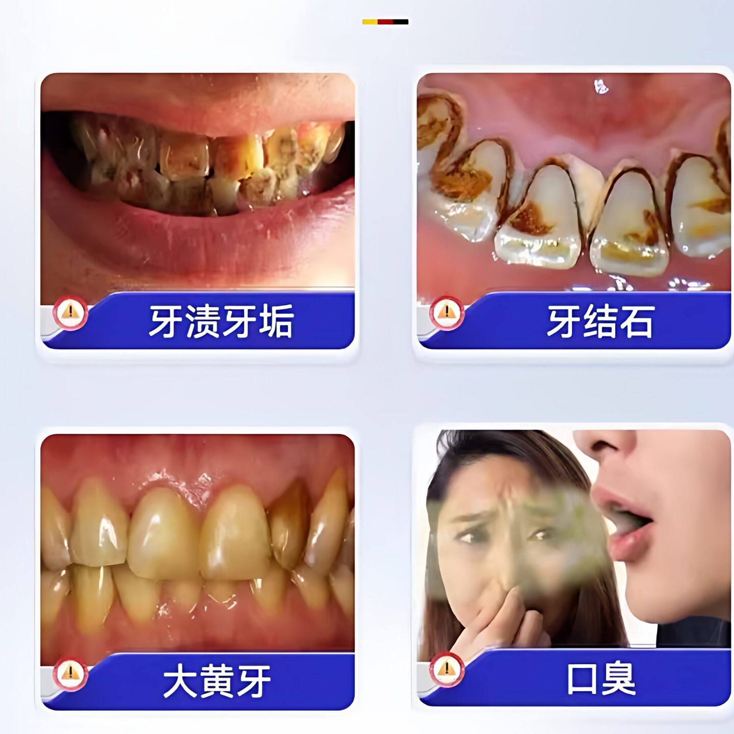 【德国专研】牙石溶解漱口水洗牙齿污垢牙垢牙黄牙渍清理神器