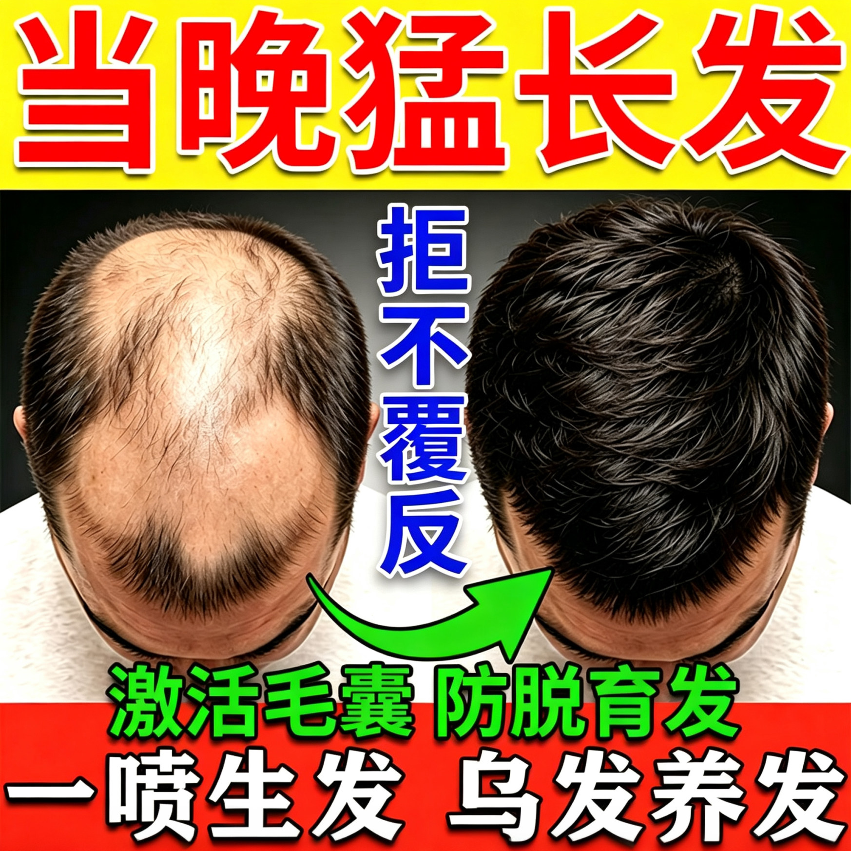 一喷猛长【永不再秃】
