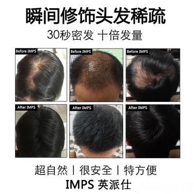 新款IMPS发际线填充浓密少增多美发补发发发神器密发增发假粉头纤