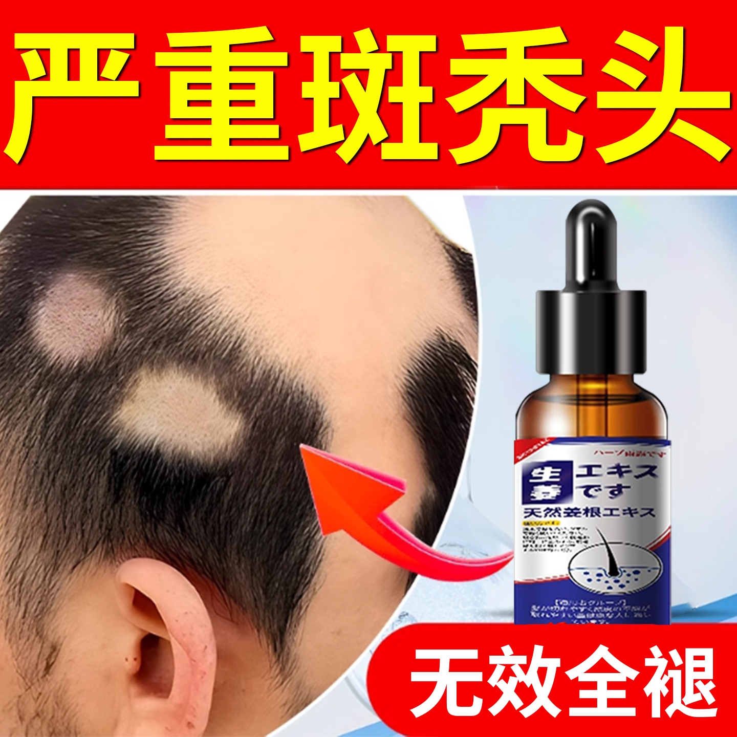 【斑秃一抹灵】生发液