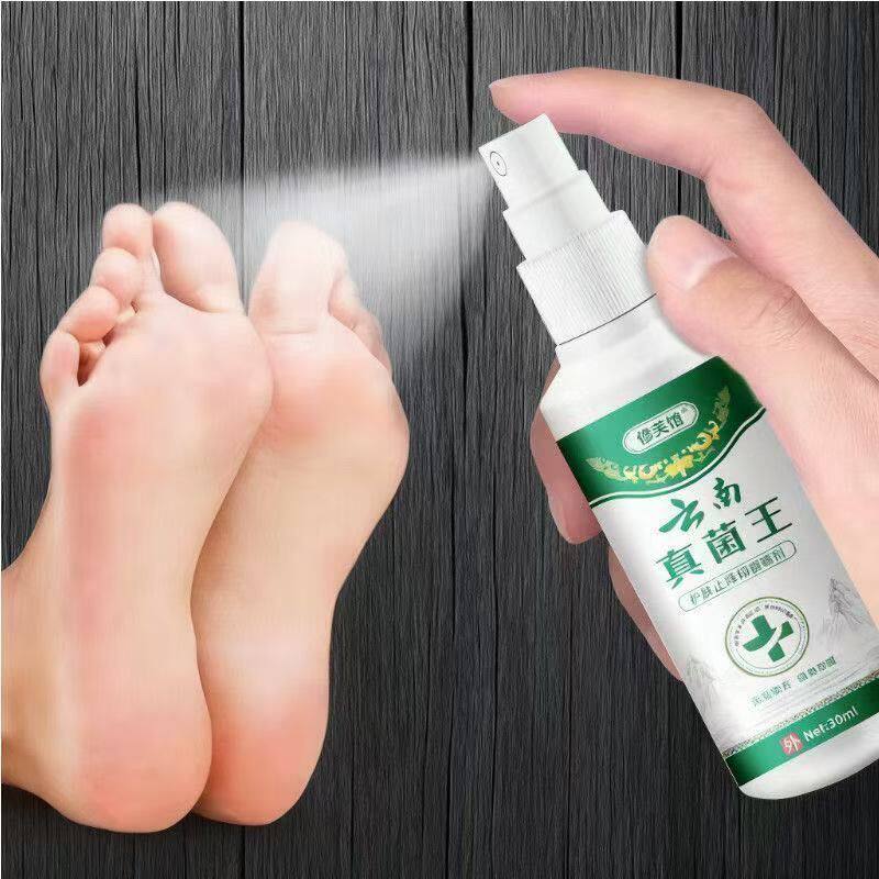 草本云南脚气王脚臭脚痒脚起泡烂脚丫脱皮香港脚止庠喷雾剂