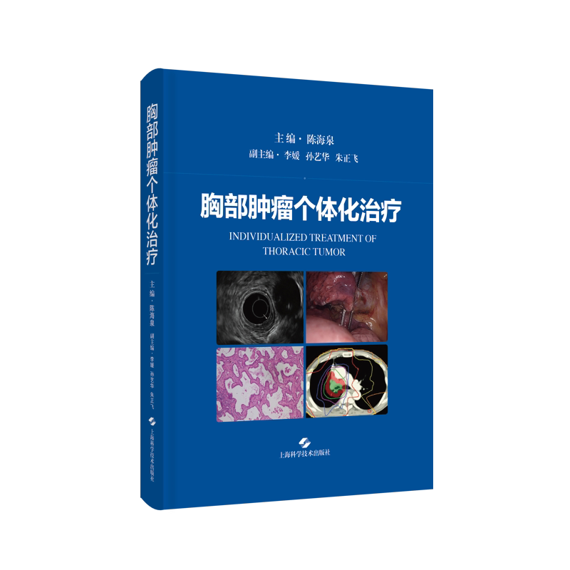 胸部肿瘤个体化治疗 胸腔疾病治疗肺癌食管癌胸外科呼吸科上海科学