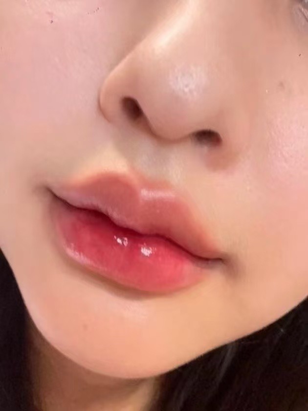 多型胶原.活肽.丰唇蜜 | 进口 透皮原料 填充唇部