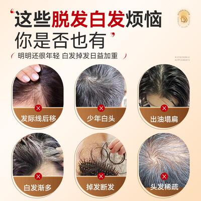 非健贝说幸福卫士硒生物素白头发内调转头发非IFB防黑发营脱掉头