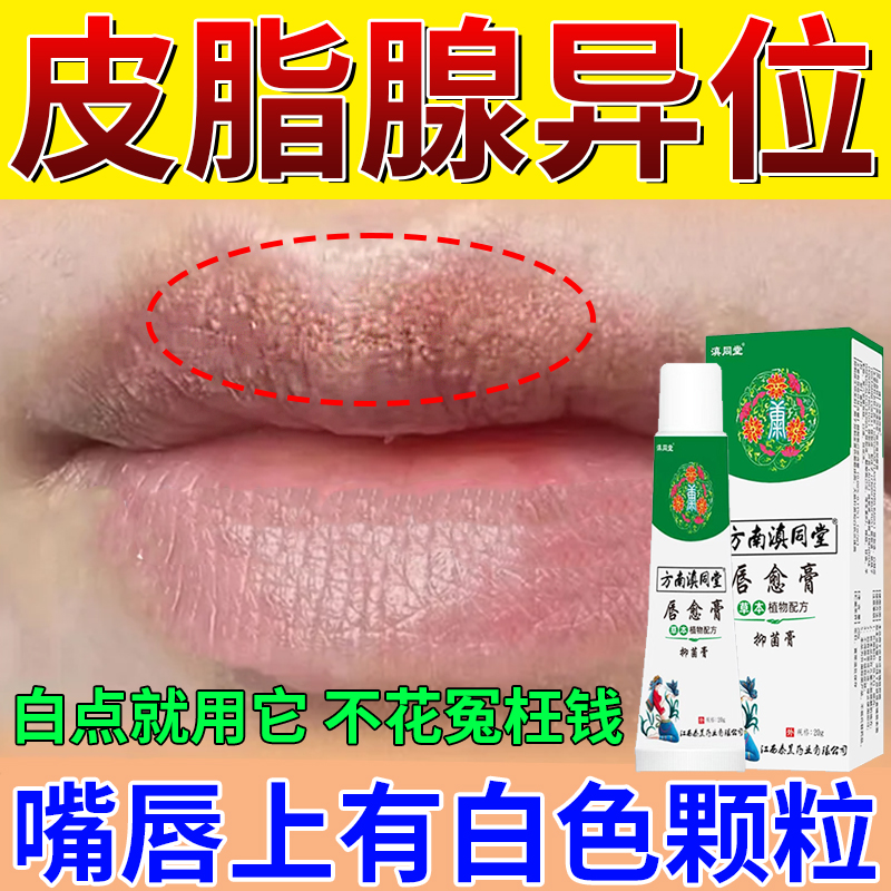 皮脂腺异位症嘴唇上长小白点脂肪小颗粒皮脂腺增生嘴巴干燥囊肿膏