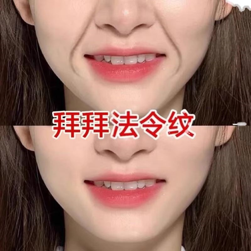 【小红书推荐】屈臣氏 适合急性子 告别法令纹 淡化嘴角纹~抗皱贴