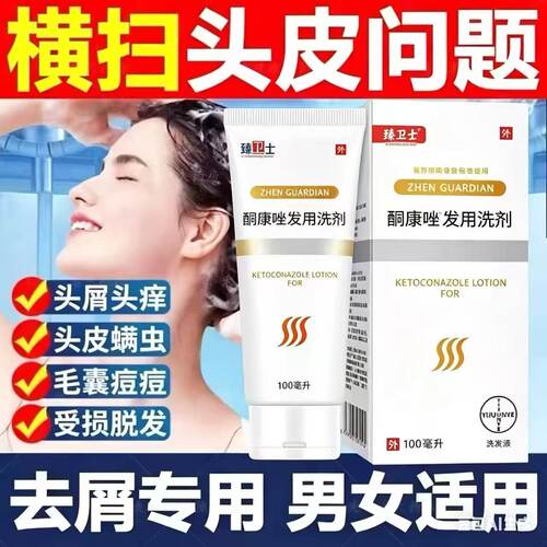 【药店同款】酮康强效去屑痒洗发水清洁去头皮经典老牌子洗发露