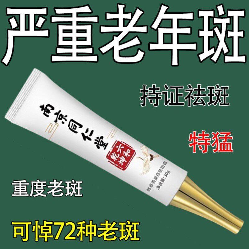 去老人斑专用药膏去斑霜祛老年斑专用脸部去手上手部手背