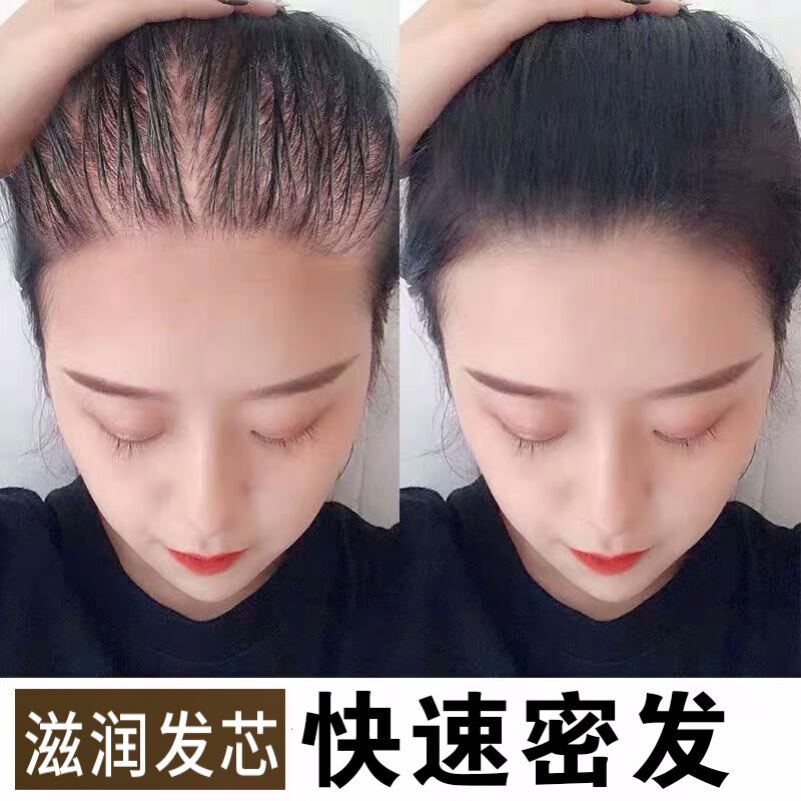 白黑客育发液防脱育发增发密发浓密护发头皮营养液护理头发增长液