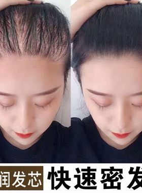 白黑客育发液防脱育发增发密发浓密护发头皮营养液护理头发增长液
