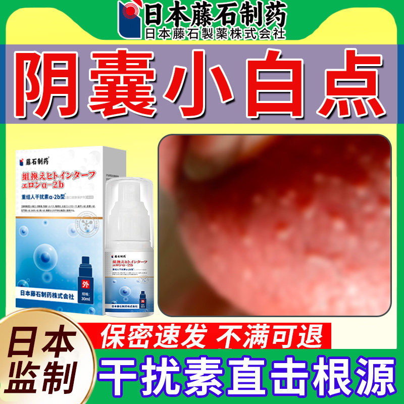 日本阴囊小疙瘩皮脂腺异位症包皮蛋皮上白点潮湿疹瘙痒喷雾剂pr