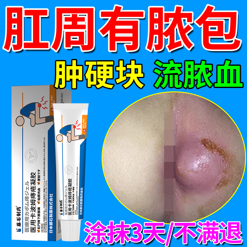 【天猫正品】肛周脓肿肛瘘封口膏