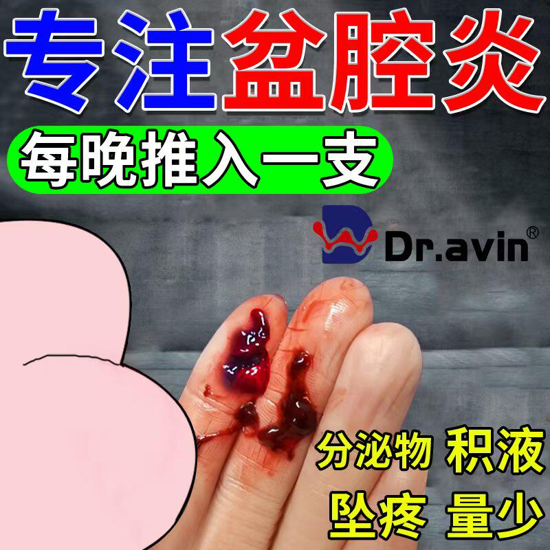 慢性盆腔炎栓剂热敷包疗盆腔积液中药贴消妇科炎症调理偏方OA