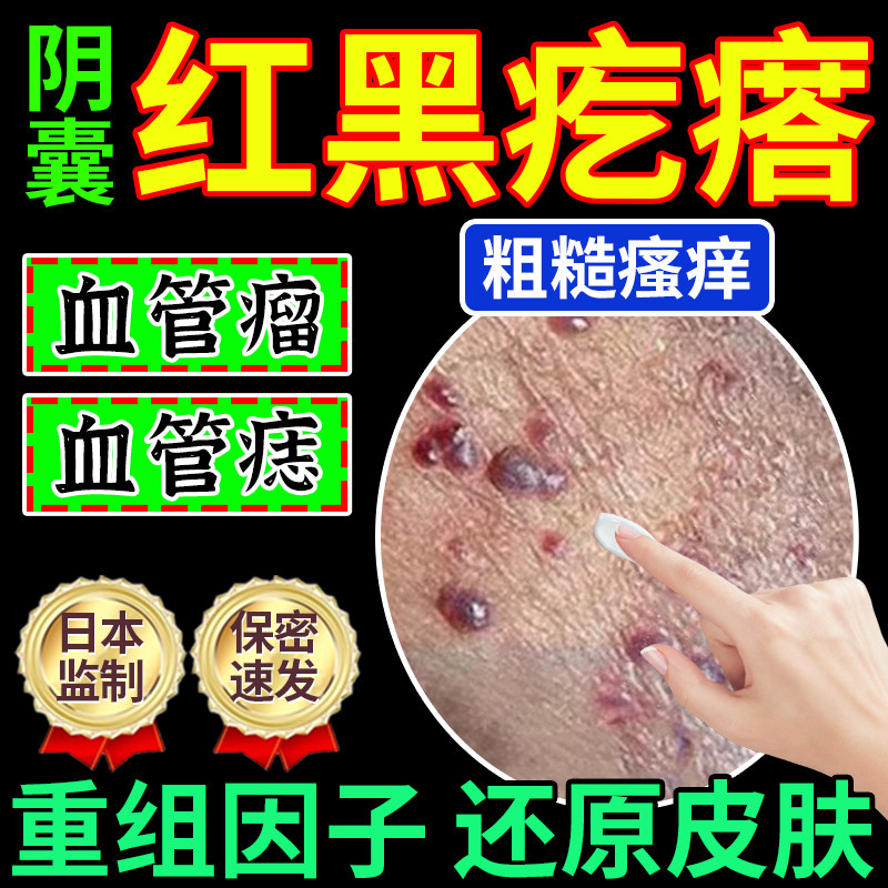 阴囊血管角化瘤黑红疙瘩血管痣蜘蛛痣红斑按压疼痛真菌感染le