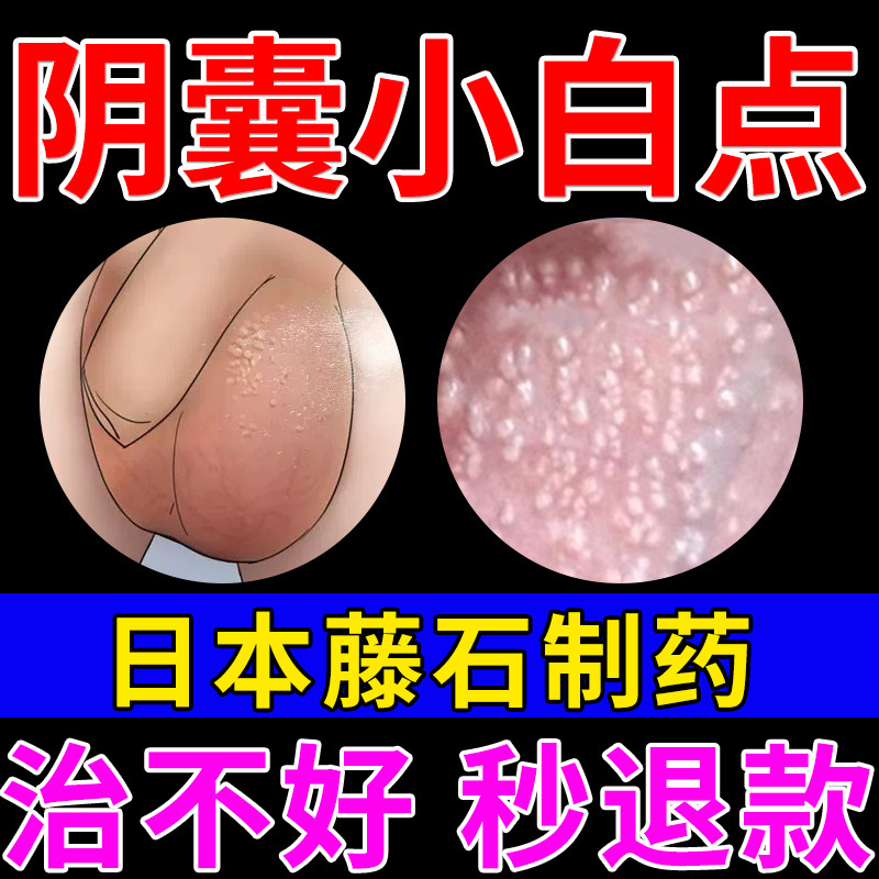 男性皮脂腺异位症私处阴囊小白点蛋皮上长疙瘩睾丸蛋潮湿瘙痒le