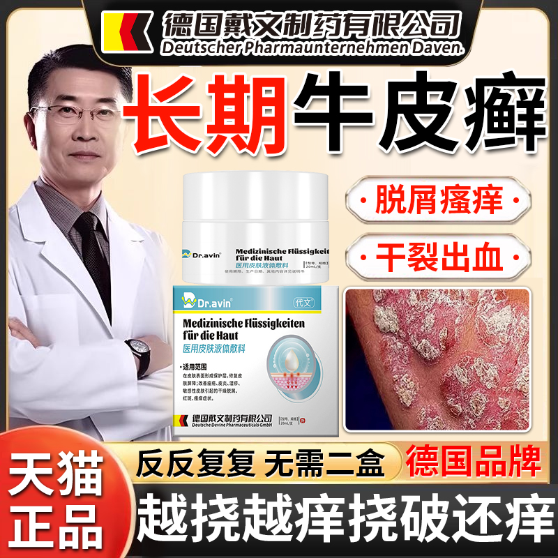 【德国品牌】牛皮癣藓银屑病膏