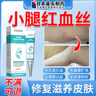 藤石制药大小女性腿上有红血丝静脉曲张皮肤修复凝胶青筋凸起xu