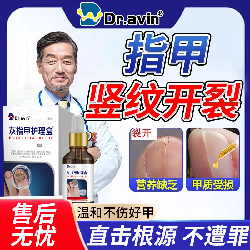 指甲断裂直击根源一次买对