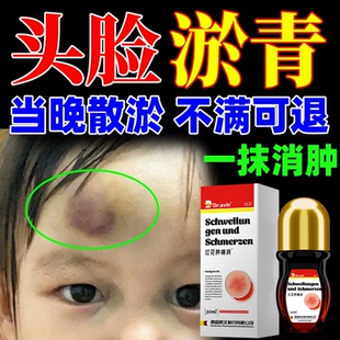 头脸淤青快速除活化瘀血外用止痛消红肿跌打损伤撞伤发紫专用膏WT