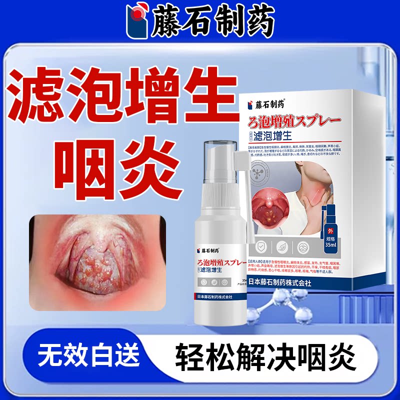 滤泡增生慢性咽喉炎淋巴喉咙干痒咳嗽嗓根子效有痰异物感除特药WT