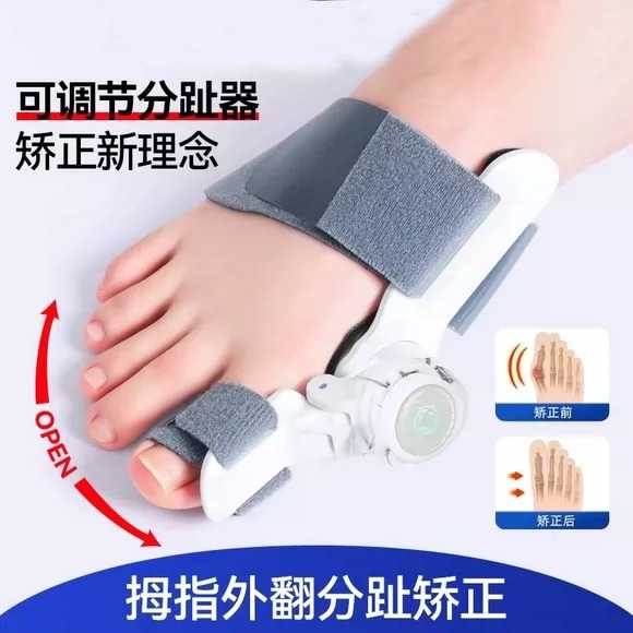 大拇指外翻矫正器可调节改善纠正