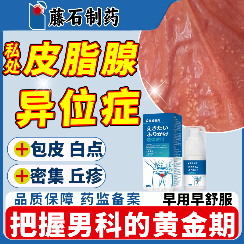 包皮生殖器皮脂腺异位症阴茎有小疙瘩阴囊白色白点脂肪颗粒水泡LJ