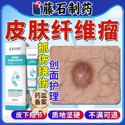 【医用级别】皮肤纤维瘤