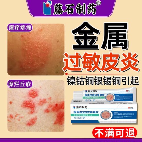 防皮肤金属过敏贴镍钴铜银锡铜瘙痒红斑接触性皮炎可搭膏药贴CS