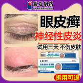 眼皮癣神经性皮炎眼皮红肿痒眼睛周围干燥起皮过敏眼角发痒掉屑SE