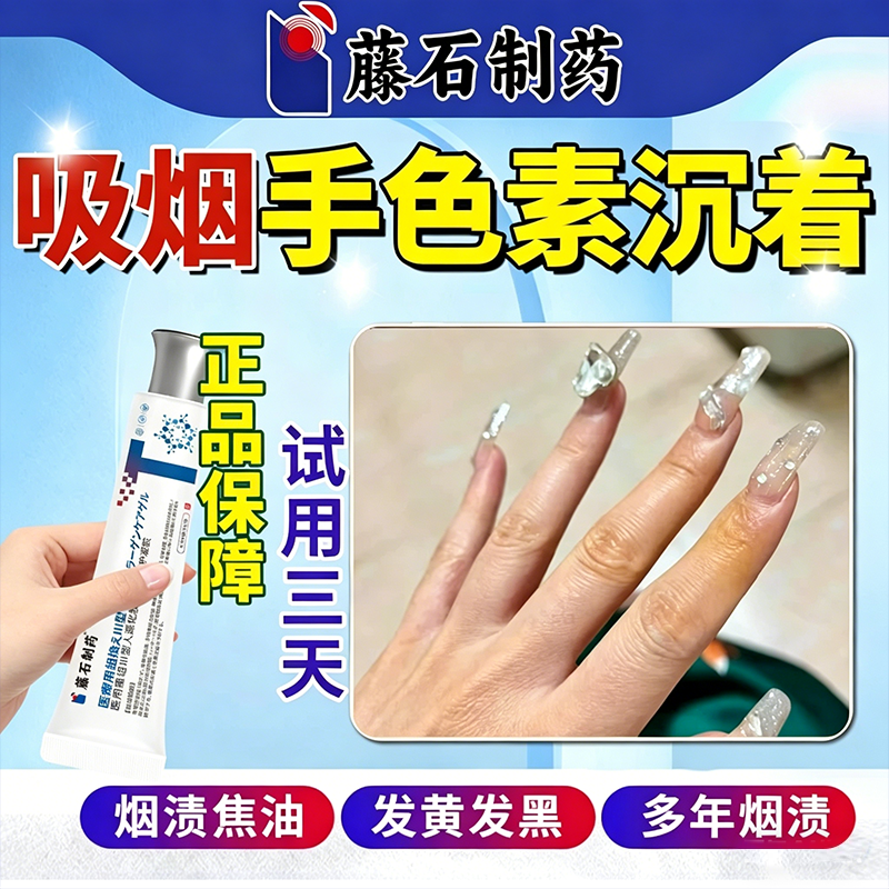 手上烟渍抽烟手指发黄色素沉着发黑清洁指甲被熏黄关节去专用CS