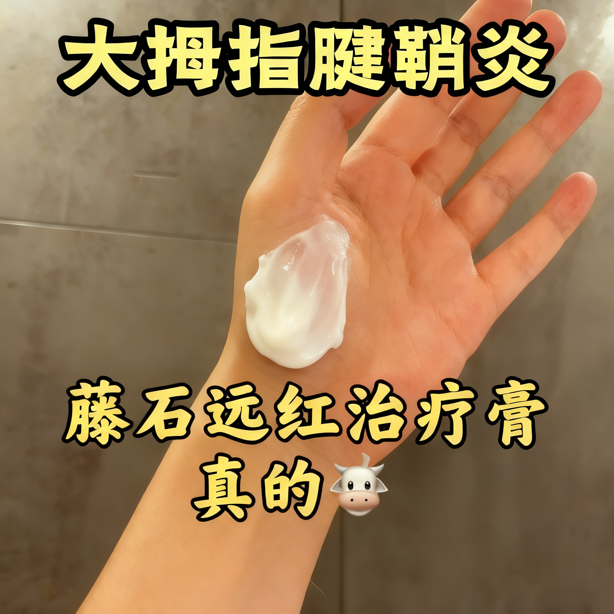 大拇指腱鞘炎的专用可搭膏药贴专用膏专用键销炎手指疼健俏炎CS