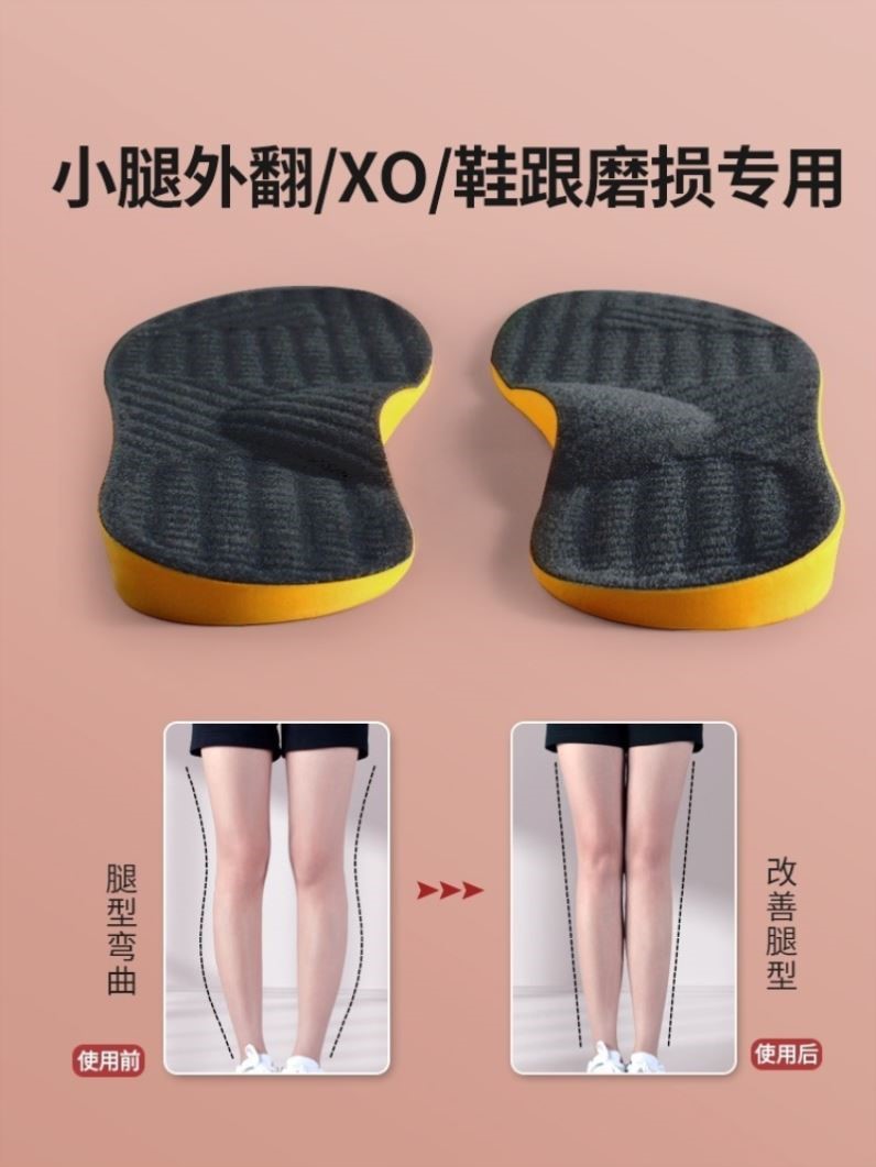 成人小腿外翻xo型腿矫正鞋垫纠正足内翻外翻鞋后跟磨损儿童直腿