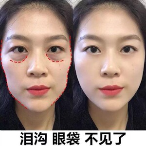 【李佳琪直播间推】跟泪沟说拜拜 眼部胶原蛋白贴膜眼袋19.9元1盒