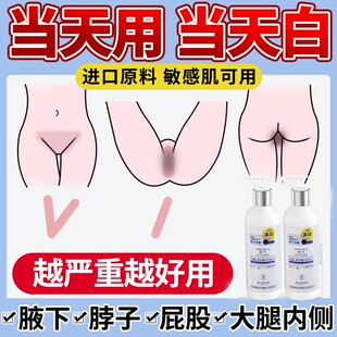 腋下美白去黑腋窝除黑手指关节胳膊肘死皮去除黑色素沉淀淡化神器