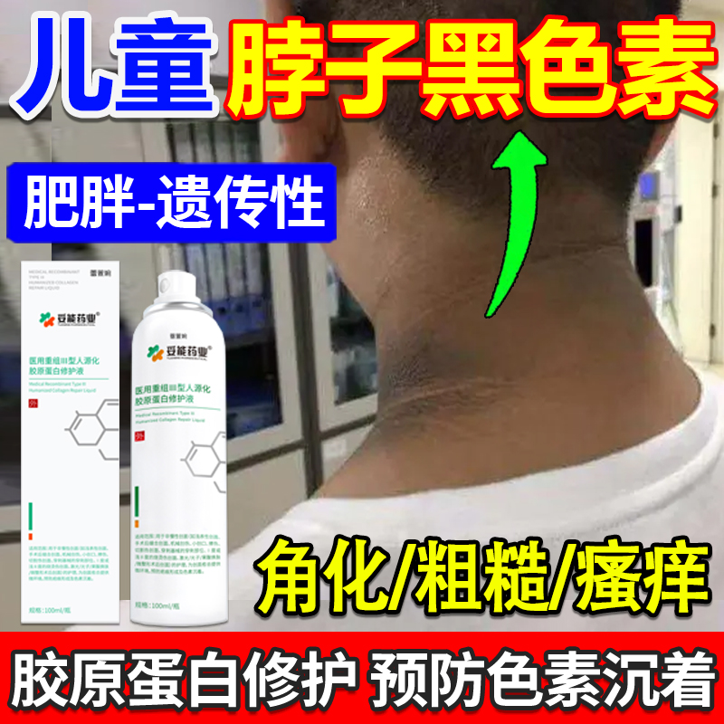 【药监局备案】儿童黑棘皮黑色素