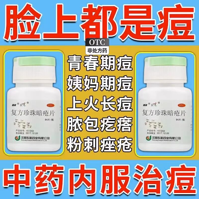 复方珍珠暗疮片鼻子上长痘痘内调祛痘背部祛痘痤疮非特效药胶囊sk