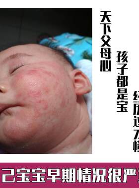 金银泡婴澡婴儿宝花宝孕妇银花洗澡儿洗KAT金澡药包金银花泡澡包