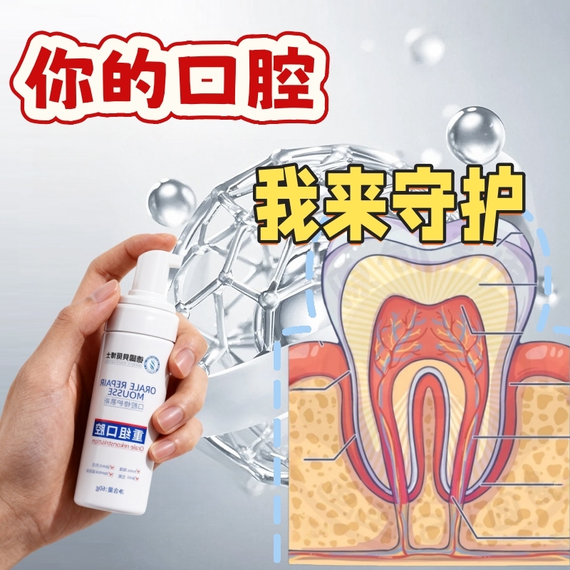 【山姆断货王】溶解茶渍烟渍污垢牙垢口腔修护慕斯牙石清理神器