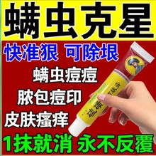 螨虫药膏止痒特效药人用脸上螨虫除螨祛痘后背杀菌淡化痘印专用药