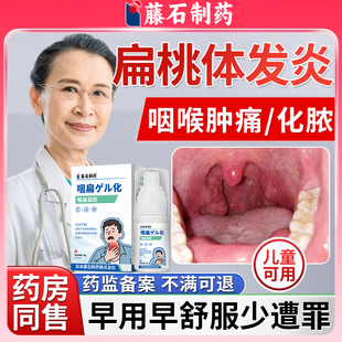 扁桃体发炎咽喉肿痛肿大贴化脓性儿童急慢性专用喷雾剂药房同售WQ