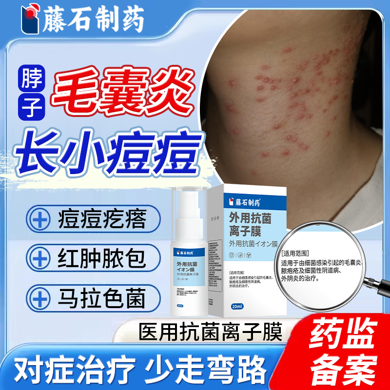 治疗脖子毛囊炎长痘痘抗菌离子膜