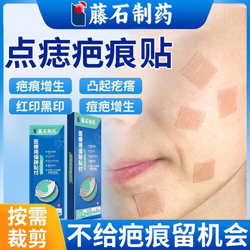 激光点痣疤痕贴医用硅酮增生